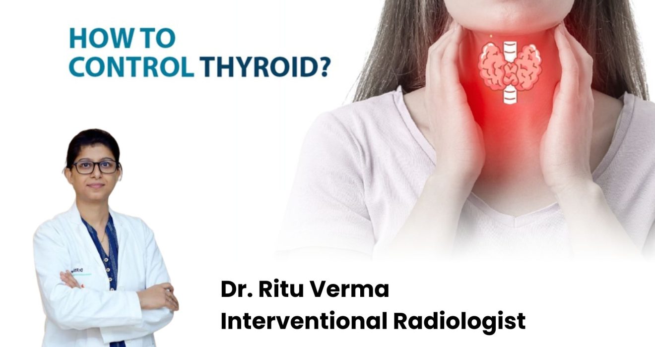 Thyroid - Dr. ritu verma